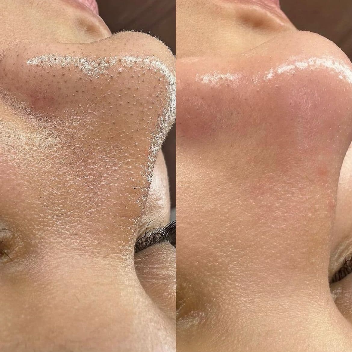 Uygulama Öncesi-Sonrası